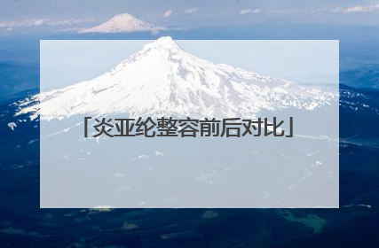 炎亚纶整容前后对比